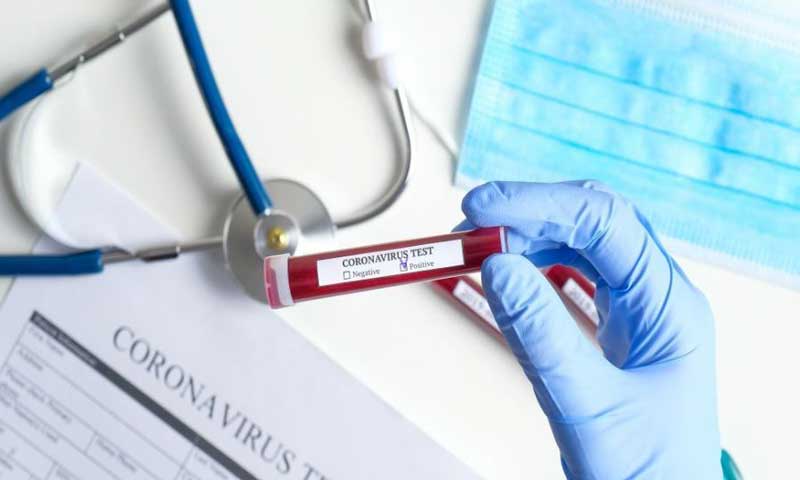 Στα “ύψη” ο αριθμός των κρουσμάτων – 284 νέα, 2 ακόμα θάνατοι, 31 διασωληνωμένοι ασθενείς