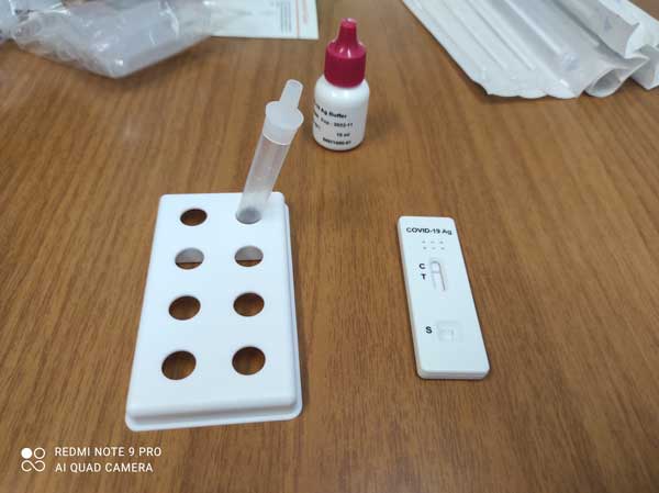 Κορωνοϊός: Ο Δήμος Κοζάνης εξασφάλισε 3.000 rapid tests για εργαζομένους και δημόσιους φορείς υγείας