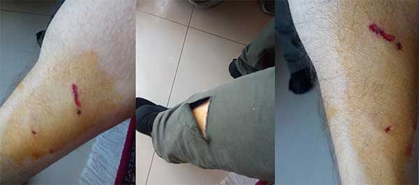 Αδέσποτο σκυλί επιτέθηκε και δάγκωσε πολίτη στην Πτολεμαΐδα