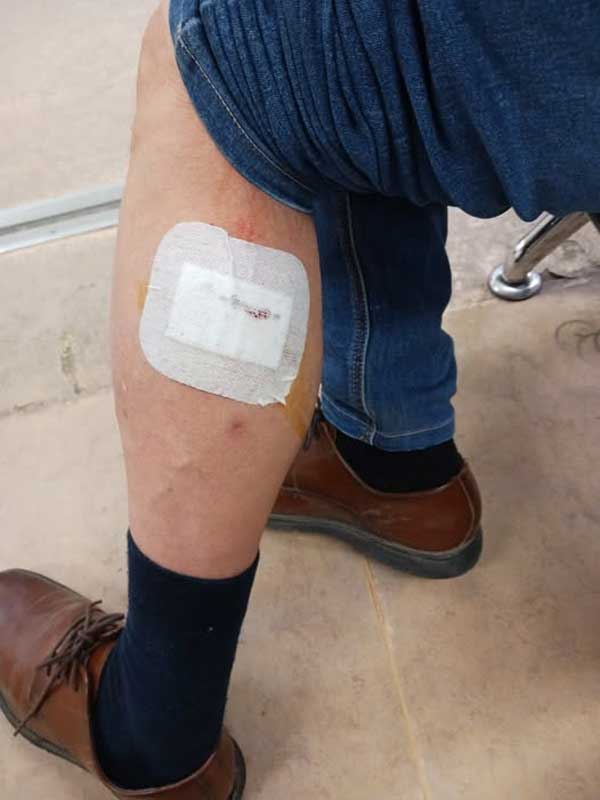 Επίθεση από αδέσποτα στην Πτολεμαΐδα με τραύμα στο πόδι